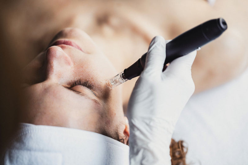 Microneedling and fractional laser treatment creating controlled micro-injury to stimulate dermal skin repair